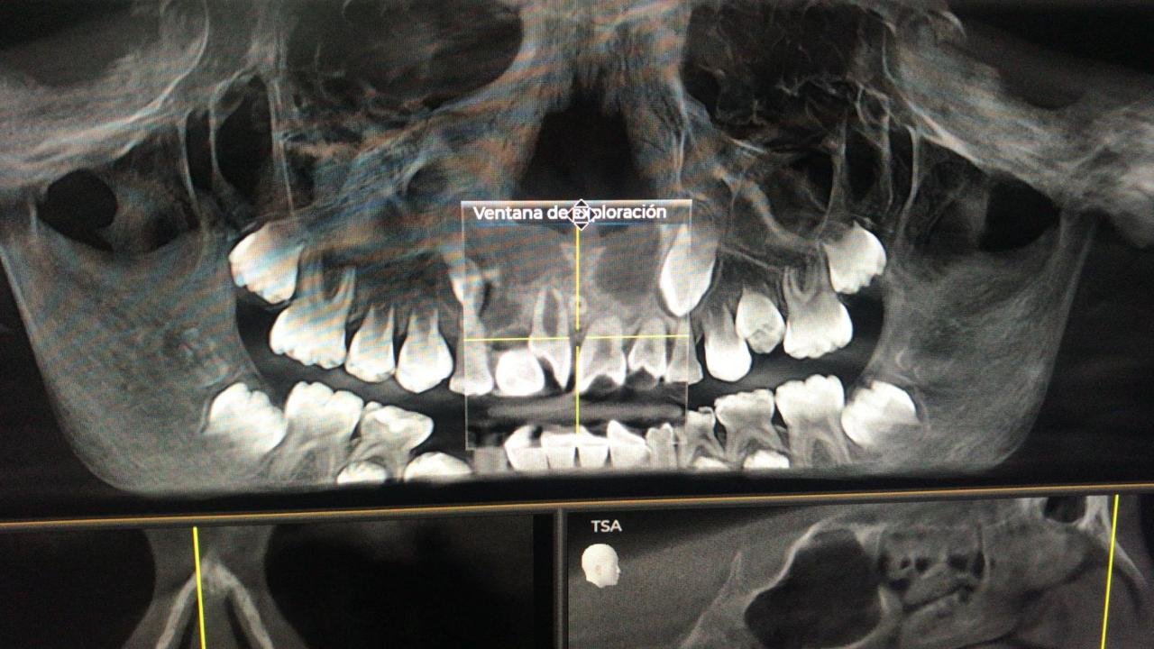 Resultados Dental RX