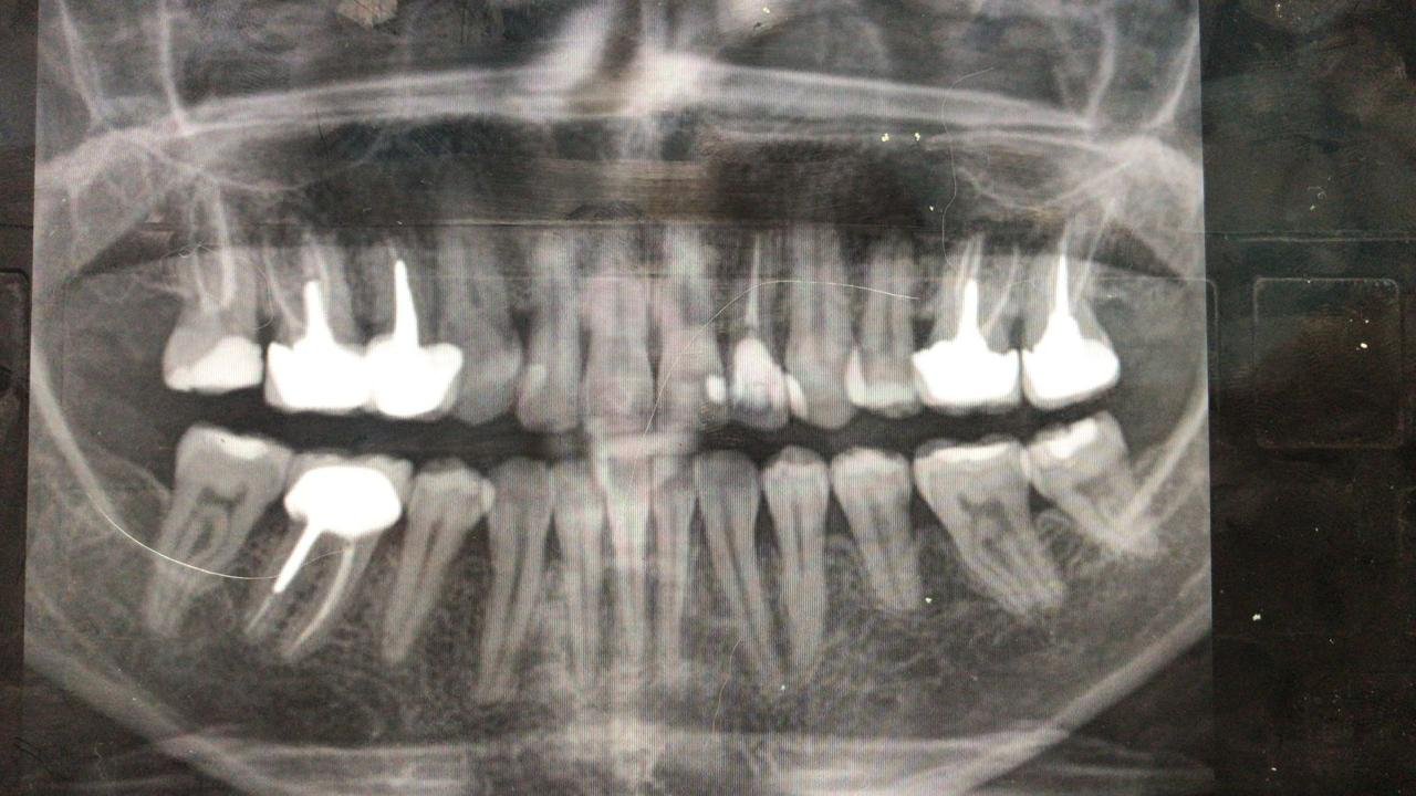 Fotografía dental Dental RX